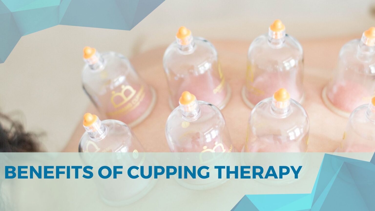 Benefits Of Cupping Therapy Cupcure