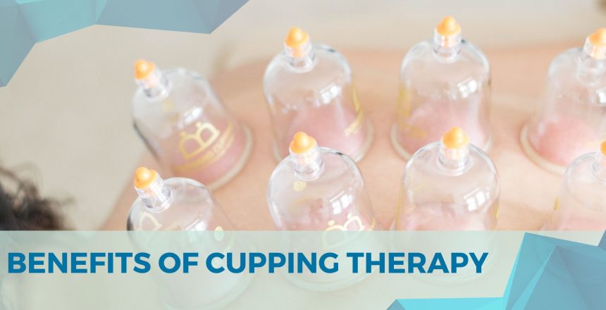 Benefits Of Cupping Therapy