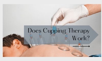 Does Cupping Therapy Work?